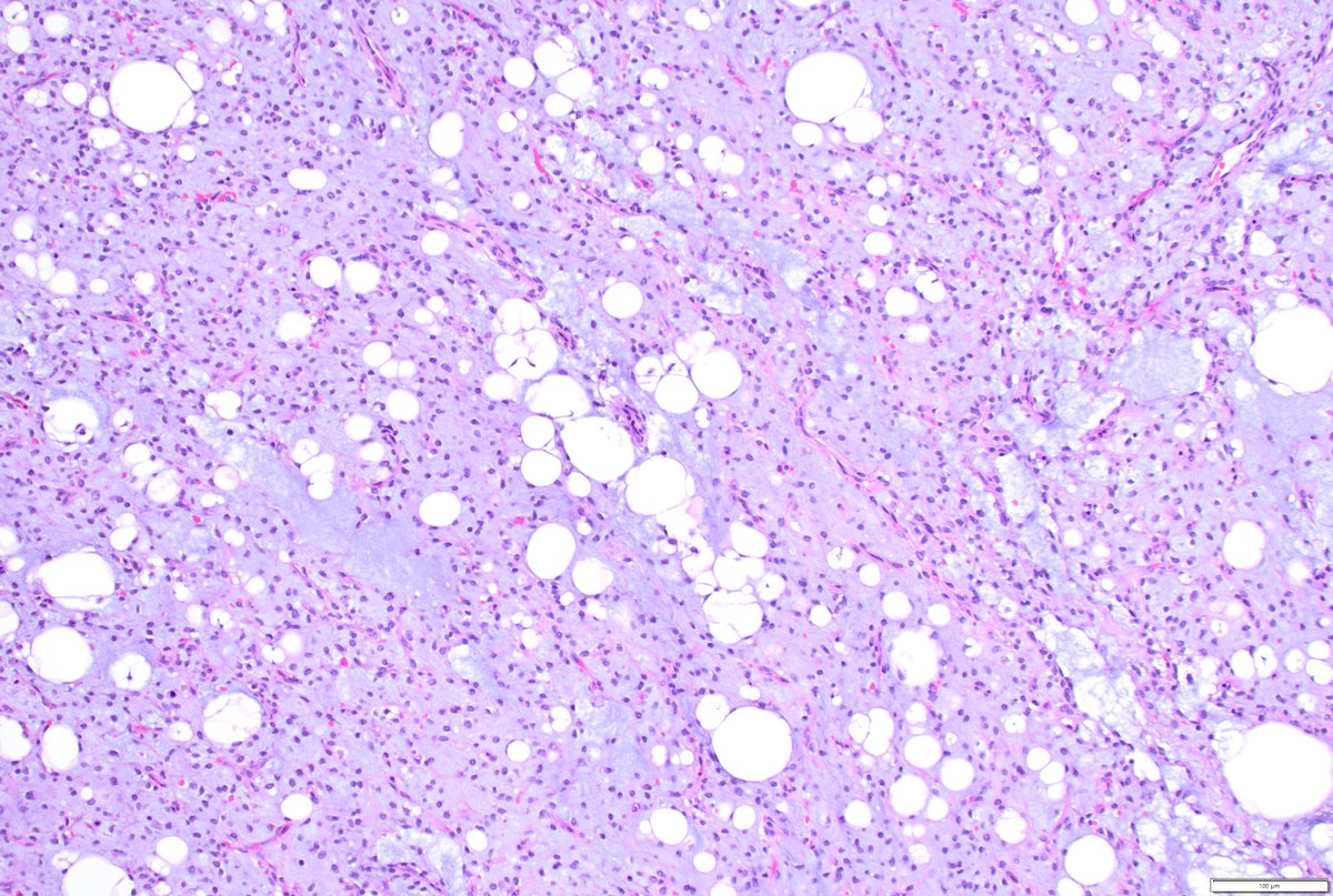 Humberto Trejo Bittar, MD, FCAP tweet media