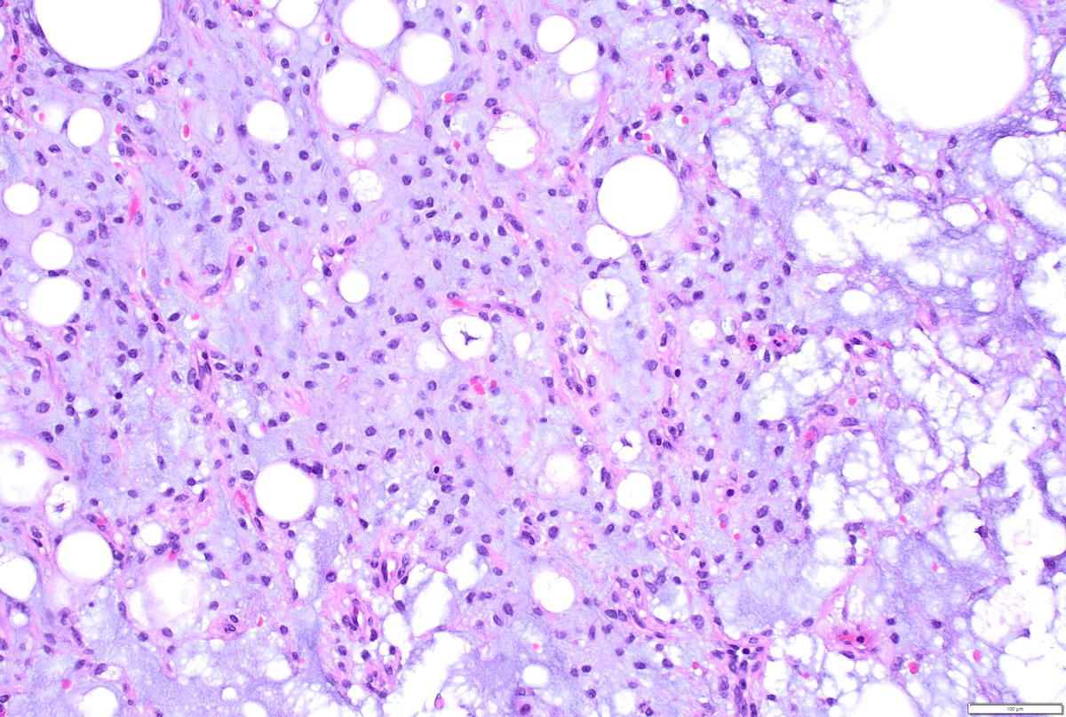 Humberto Trejo Bittar, MD, FCAP tweet media