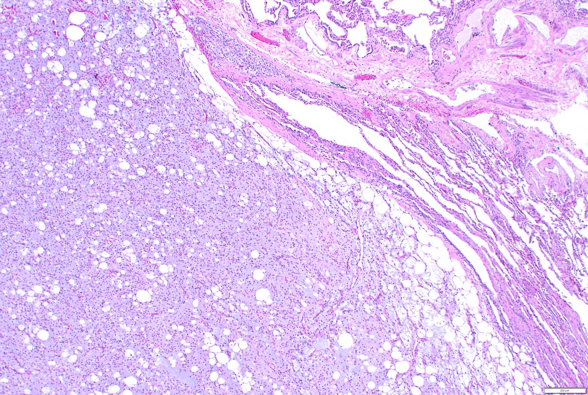 Humberto Trejo Bittar, MD, FCAP tweet media