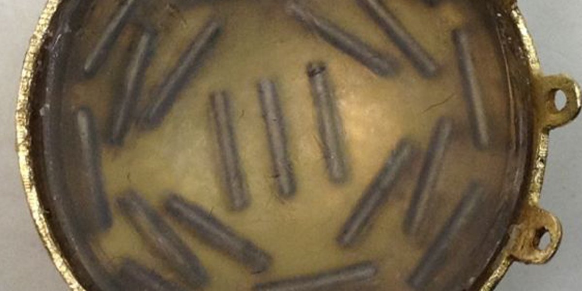eyewiki's tweet photo. What does a radioactive plaque look like for the treatment of #choroidal melanoma? Check it out here. #aao #ophthalmology #ocularoncology https://t.co/WofSaUa7Lv https://t.co/5bN3SURVIz