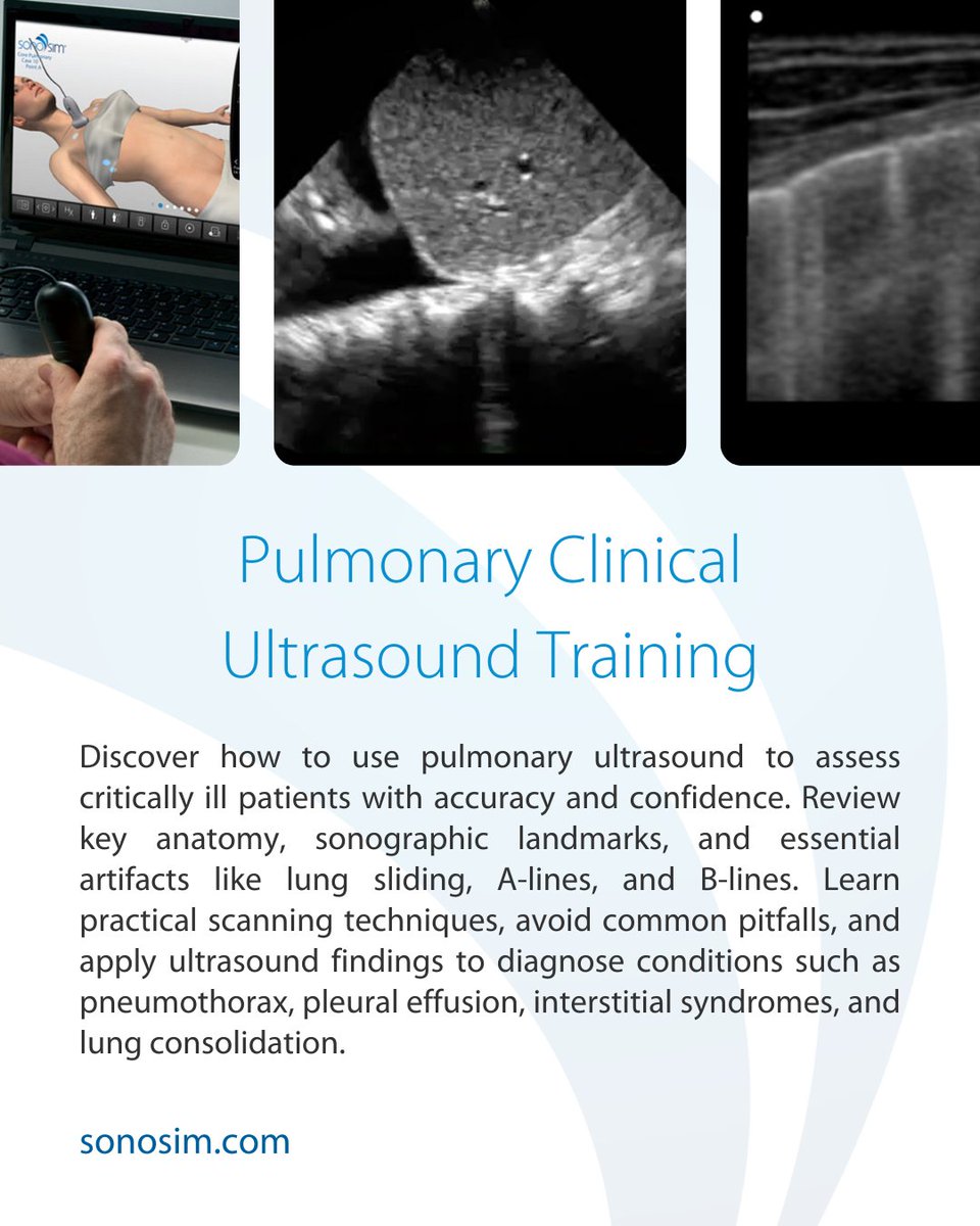 SonoSim, Inc tweet media