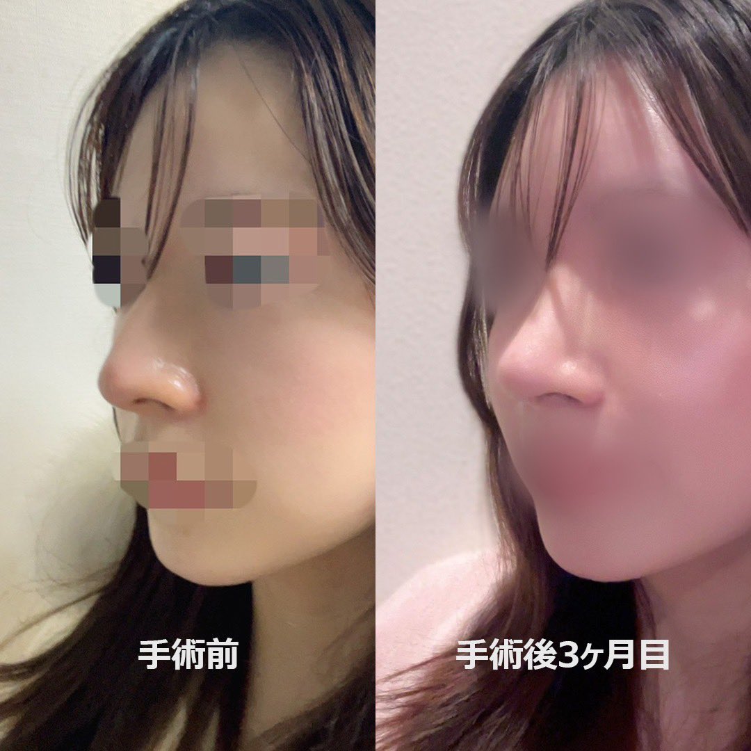 u 🇰🇷鼻フルDT中 tweet media