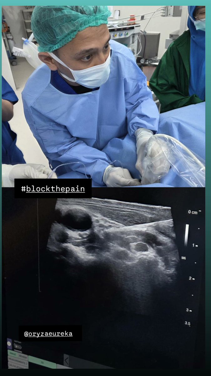 Sympharetic block (stellate usg guided and lumbal fluoroscopy guided). Pain specialist journey
