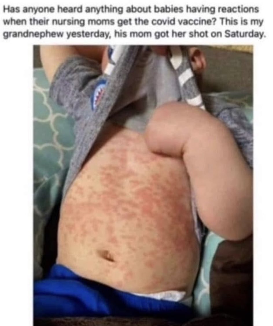 “Has anyone heard anything about babies having reactions when their nursing moms get the covid vaccine? This is my grandnephew yesterday, his mom got her shot on Saturday.”