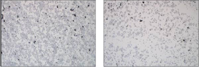 cancerscnews's tweet photo. Scientists demonstrate that GDF15 acts as a tumor promoter in colorectal cancer by driving EMT, facilitating proliferation and metastasis, and enhancing cancer #stemness.
π Read the full study: https://t.co/iVm26J943w https://t.co/SlEtUuk1LB