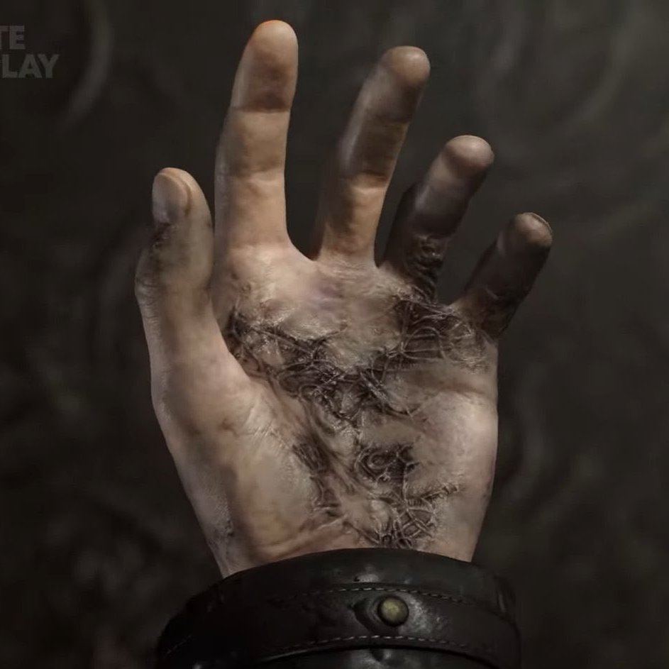 screentime's tweet image. Leon S. Kennedy is infected in 'RESIDENT EVIL: REQUIEM' 

"Leon, we're running out of time"