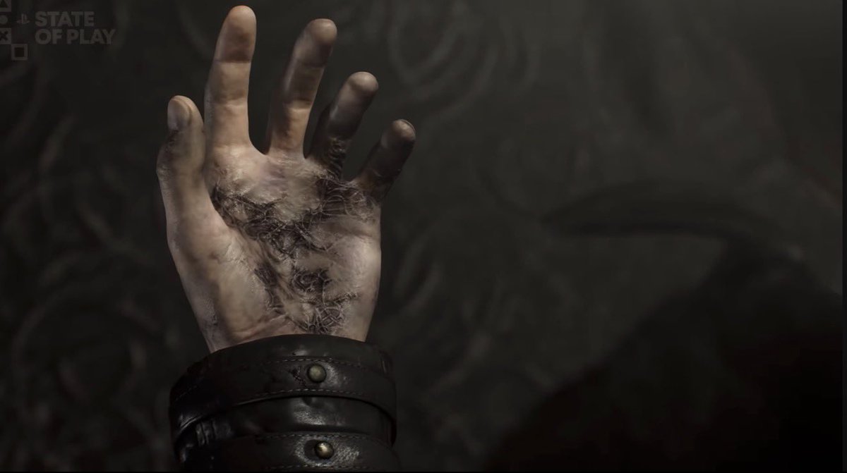 REBiohazardNews's tweet image. Leon is infected with Raccoon City Syndrome.

Survivors of raccoon city have dormant remnants of the T-Virus residing within their bodies. In stage 0, the virus is dormant, slowly building immunity to antibodies.

Stage 1- Activation. The virus reveals itself in the form of black…