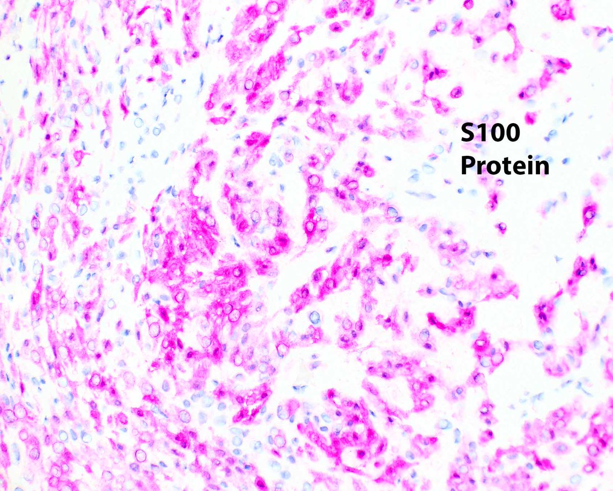 Modern Pathology tweet media
