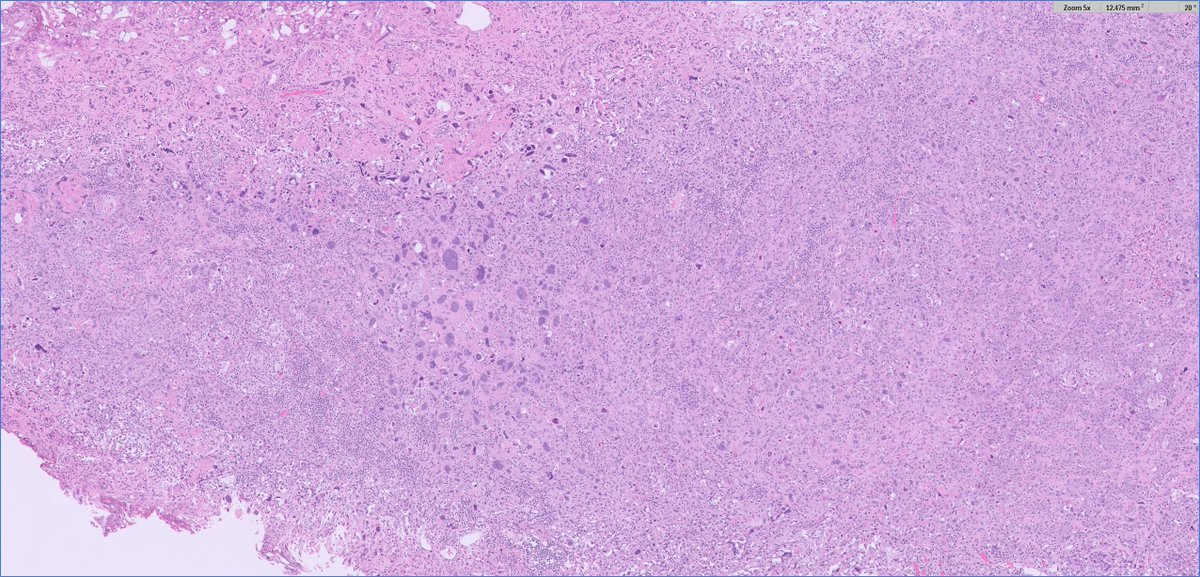 Ankur Sangoi tweet media