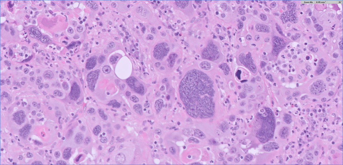 Ankur Sangoi tweet media