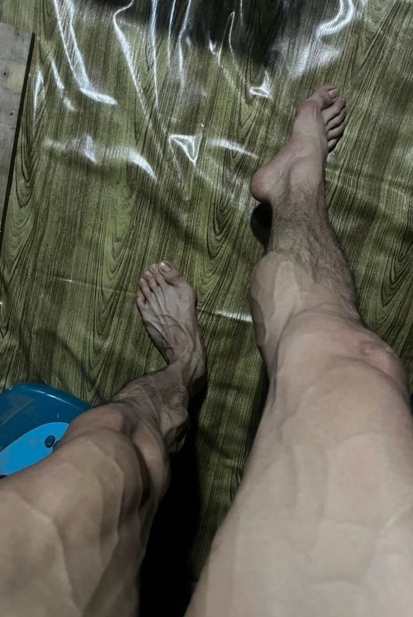 เมื่อวาน ล้มเหลว
วันนี้แค่ลุกขึ้น ยืนแล้วลงมือทำใหม่  จะไปอยากอะไรกับชีวิต