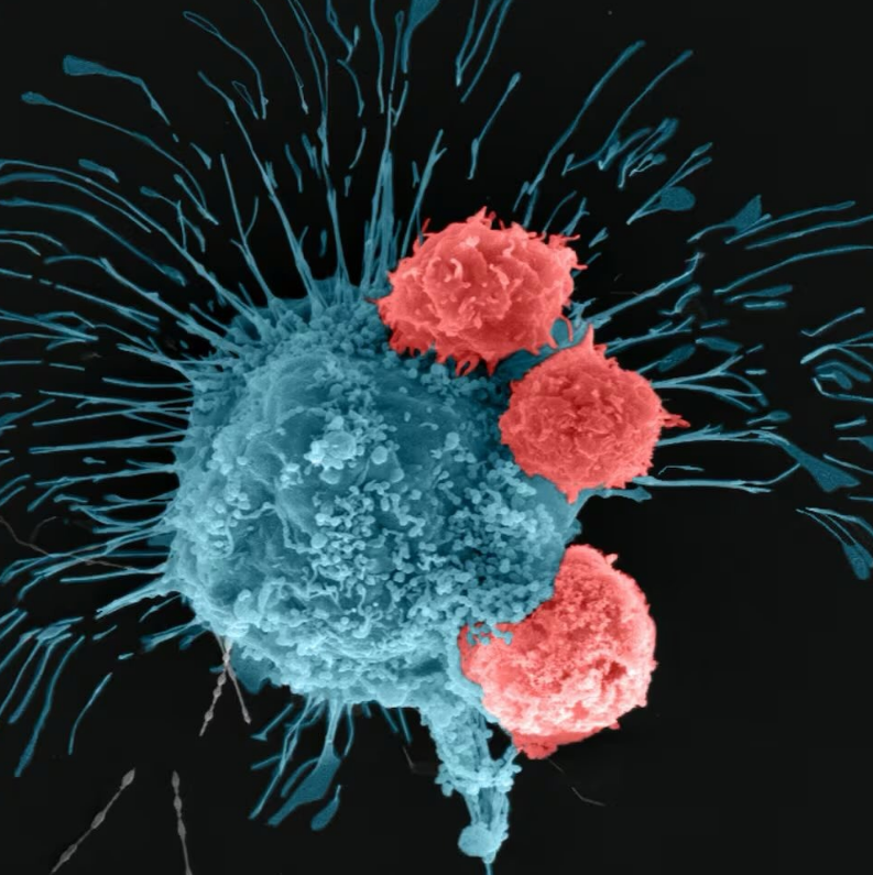 "Cáncer"

Porque Rusia anunció que su nueva vacuna contra el cáncer, Enteromix, ha demostrado un éxito del 100% en los ensayos clínicos y ahora está lista para su uso clínico.