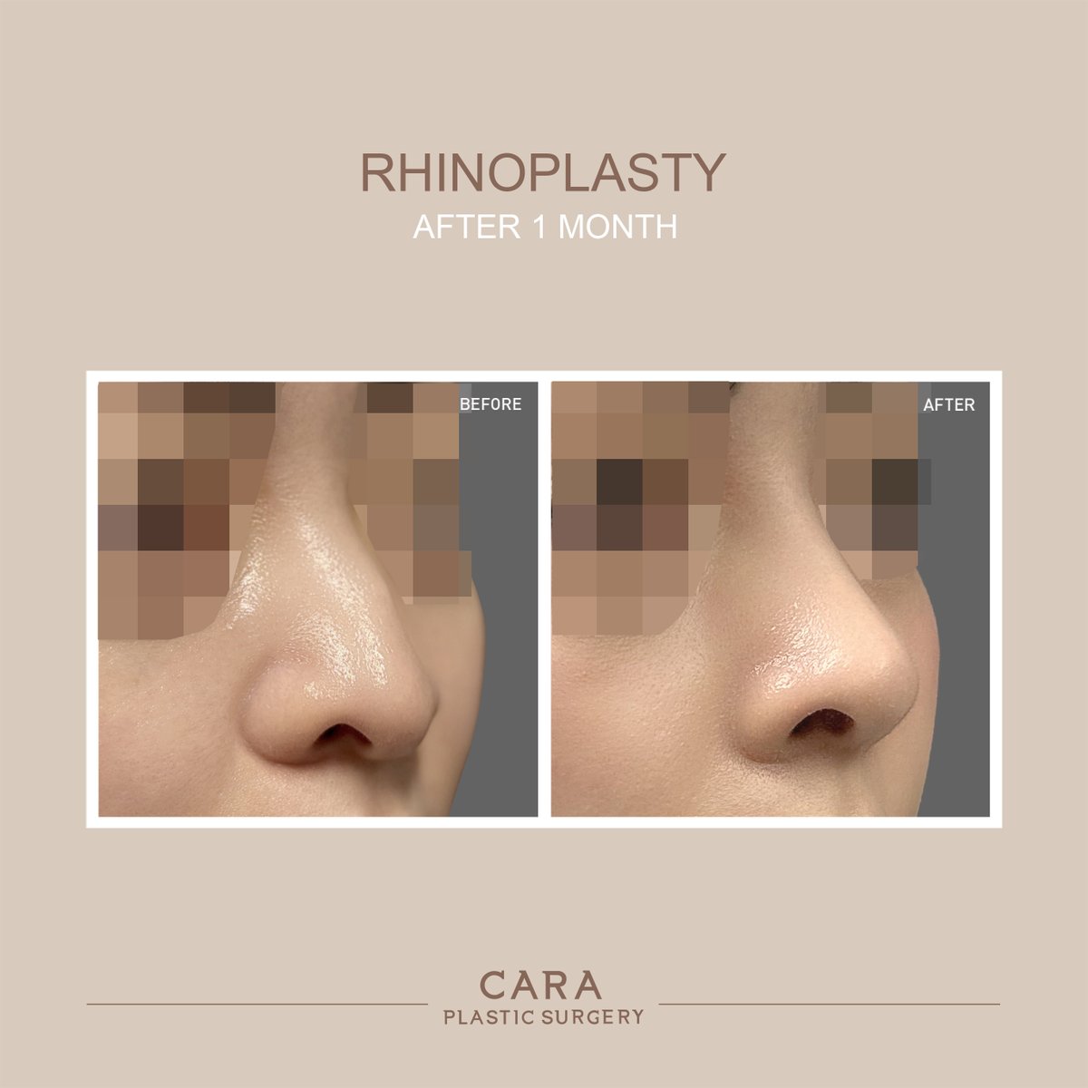 caraplasticsurgery tweet media