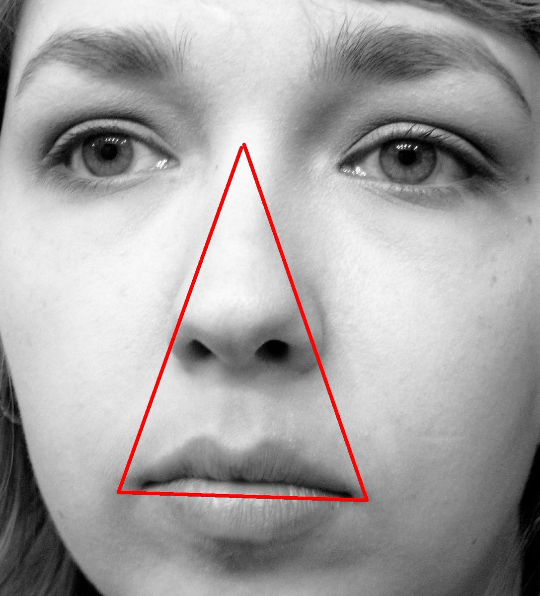You can pop a pimple in this triangular region on your face and get blind. It’s called the triangle of death.