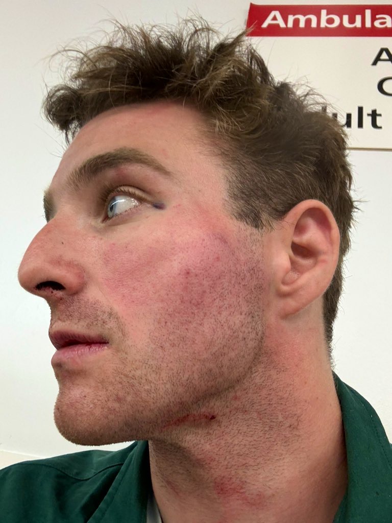 My latest for <a href="/Telegraph/">The Telegraph</a> 👇

“Police officers are expected to confront increasing levels of violence, often from armed suspects, while being denied the means to defend themselves or the assurance that the law will adequately punish and deter.”