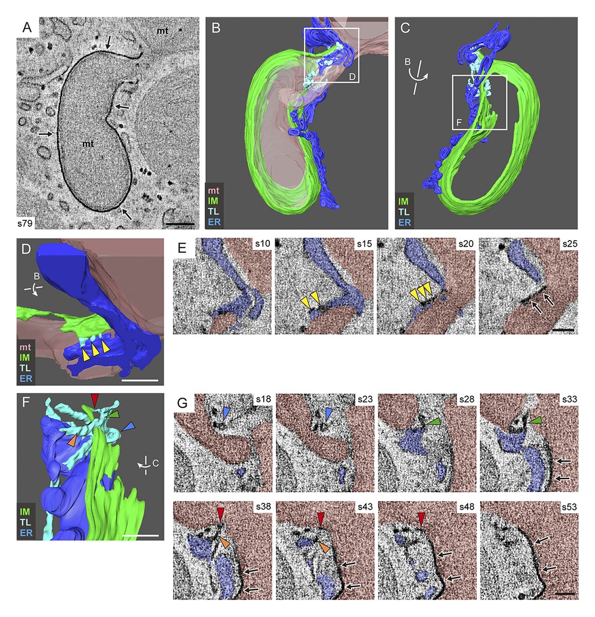 JCellBiol's tweet image. The #mitophagy receptors BNIP3 and NIX mediate tight attachment and expansion of the isolation membrane to #mitochondria. From Yamashita, Arai, Kanki, Waguri and colleagues: hubs.la/Q040Nfbv0

📕Part of #Autophagy 2026 👉 hubs.la/Q040NdGg0
#KSAutophagy26