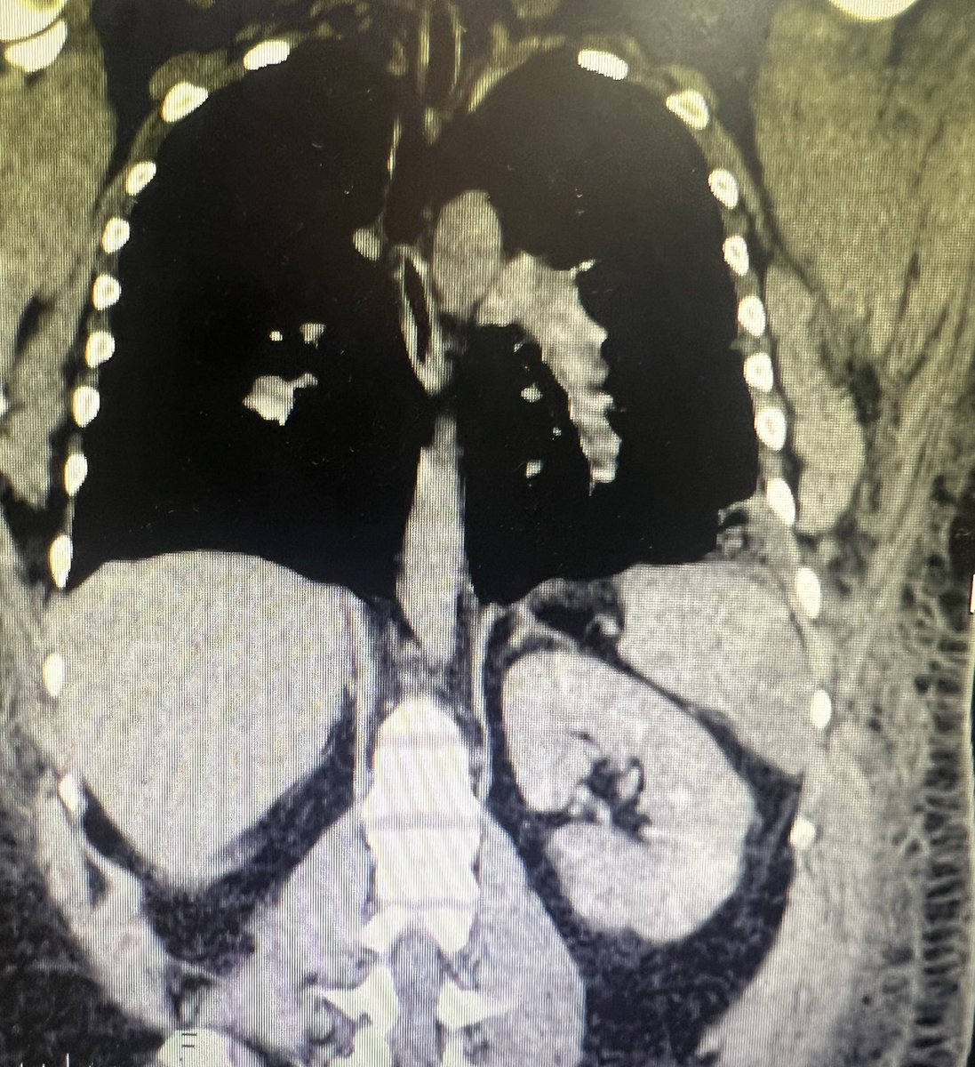 Orlando RPN tweet media