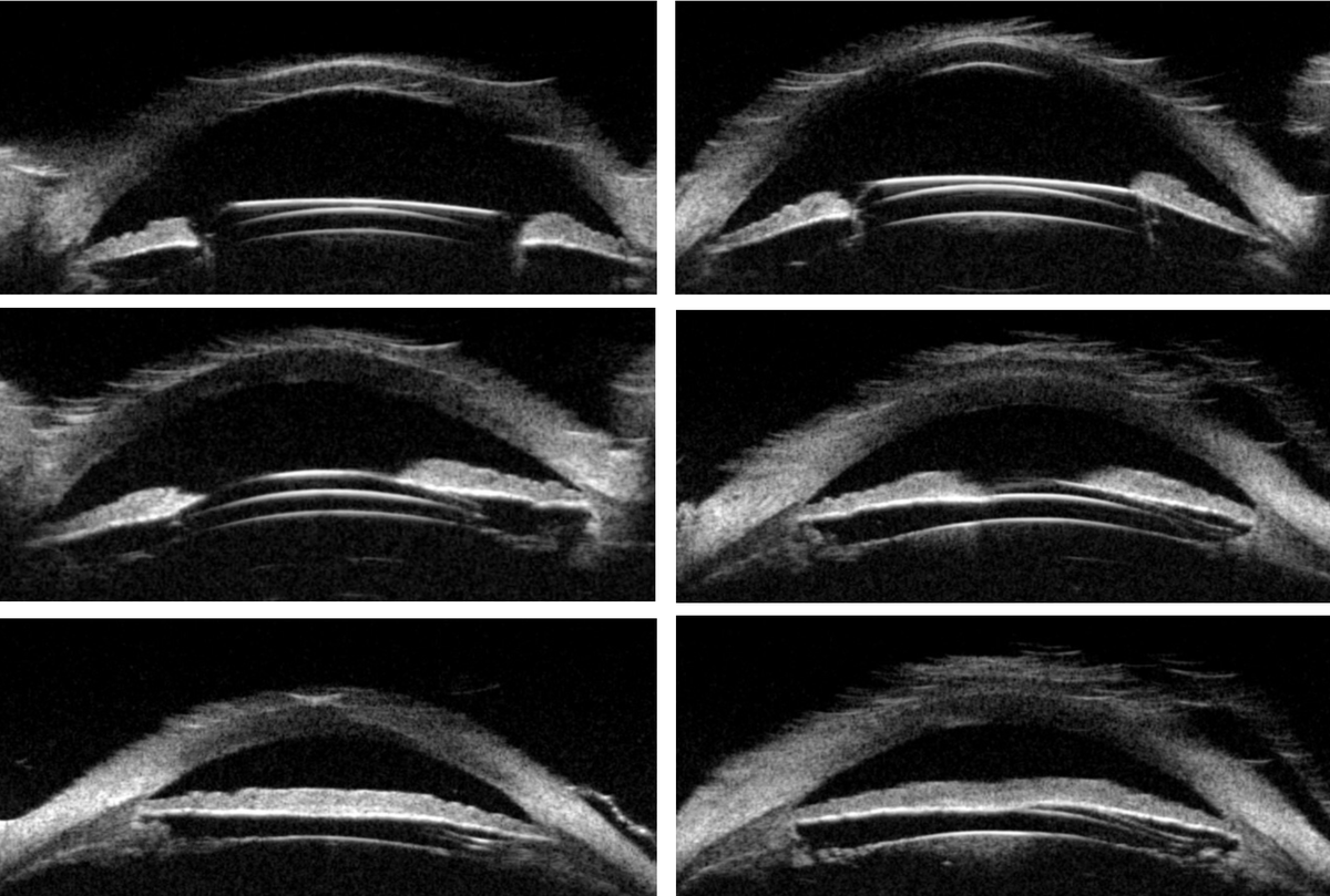 Bascom Palmer Eye Institute tweet media