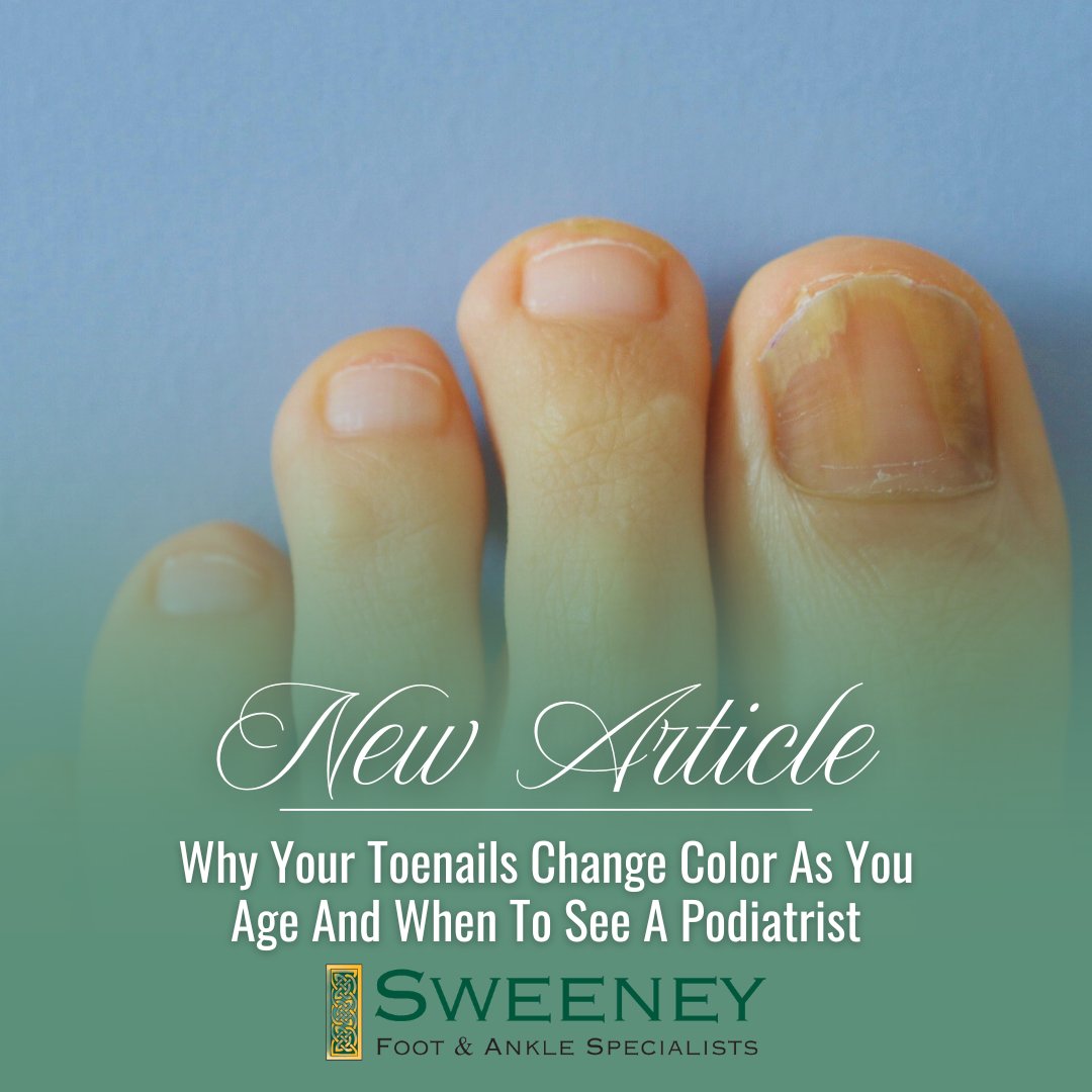 SweeneyFootDoc's tweet photo. Are your toenails looking different as the years go by? Discover why toenail discoloration occurs with age and when it’s time to seek expert podiatric care.
📌 Read More Here: https://t.co/Ea8yMdDmvS
#Sweeney #Podiatrist #FootCare #Toenails https://t.co/xTQUeTAG1m