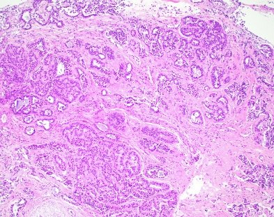 Lester Thompson tweet media