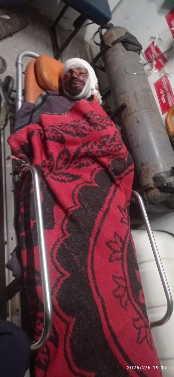 भदोही जिला दुर्गागंज थाना अंतर्गत सराय कंसराय हरदुआ में चमार समाज लोगों के द्वारा पासी समाज के लोगों के ऊपर जानलेवा हमला कुल्हाड़ी,सरिया से हमला करते समय गमछ से मुंह ढककर एक साथ दर्जन से अधिक लड़के द्वारा जानलेवा हमला #durgaganjthana <a href="/bhadohipolice/">BHADOHI POLICE</a> #durgaganjpulice