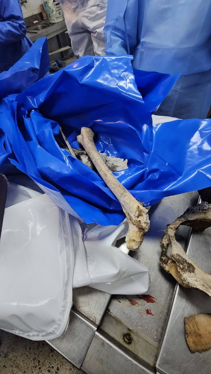 تحذير: مشاهد قاسية 🚨
بعضهم أُعدم تحت التعذيب.
هذه ليست «جثامين مُفرج عنها»، إنما بقايا شهداء من غزة: قتلٌ ثم احتجاز، ثم تسليم عظام وأشلاء لا تُشكّل جسدًا.
جريمة مكتملة الأركان، وانتهاكٌ حتى بعد الموت، وعارٌ على عالمٍ يرى ويصمت.
إن لم نَنشر.. سيبقى الصوت محاصرًا.