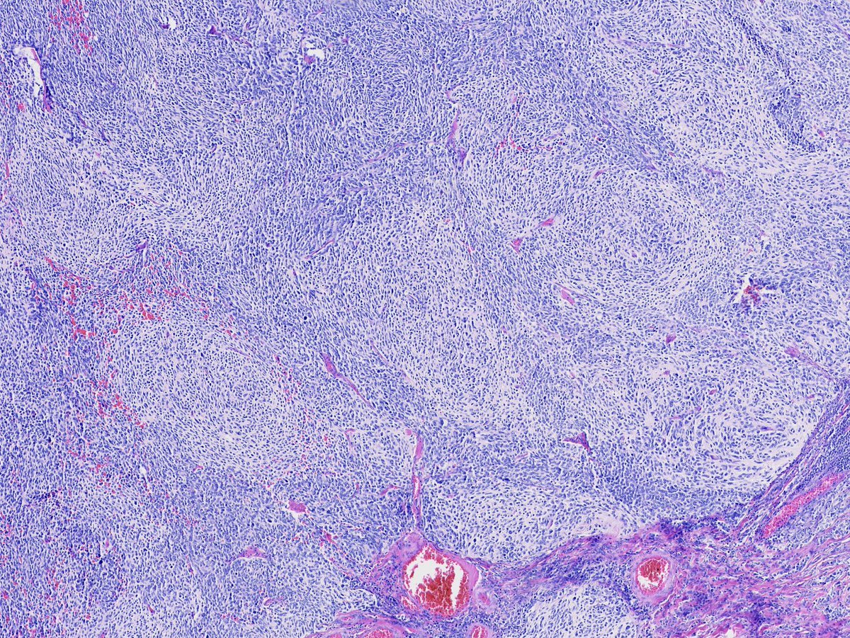 Toby Schmitt, MD tweet media