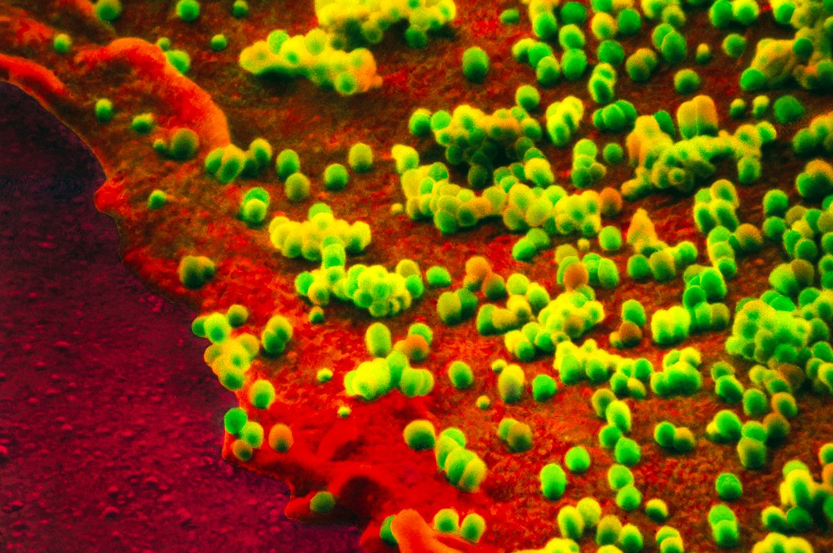 PNASNews's tweet image. Nasal RNA #FluVaccines build mucosal #immunity and may help block #DiseaseTransmission. In PNAS Journal Club: ow.ly/K1eN50Y9nm6

#RNAVaccine #influenza #H5N1 #Covid19 #pandemic