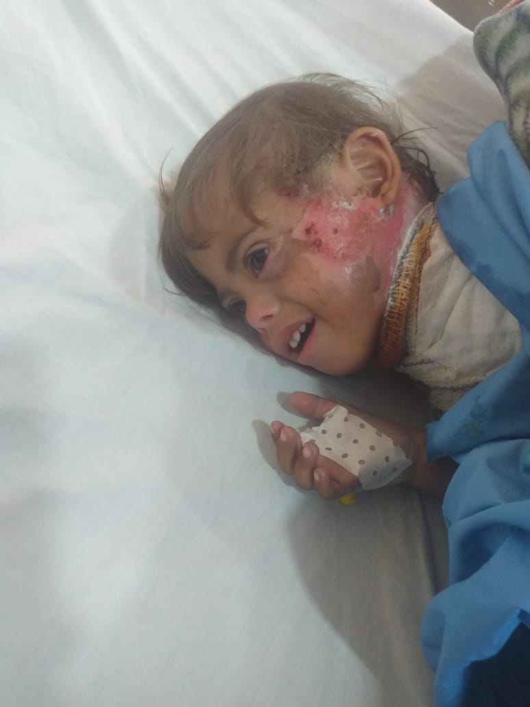 🚨 3yo Nizar Needs You!
​A boy with Down Syndrome &amp; severe burns living in a freezing tent in Gaza. His immunity is failing. He urgently needs medicine, diapers &amp; care.
​Please help him survive:
🔗 gofund.me/e2de34f82
​#Gaza #HelpNizar #DownSyndrome #Donate