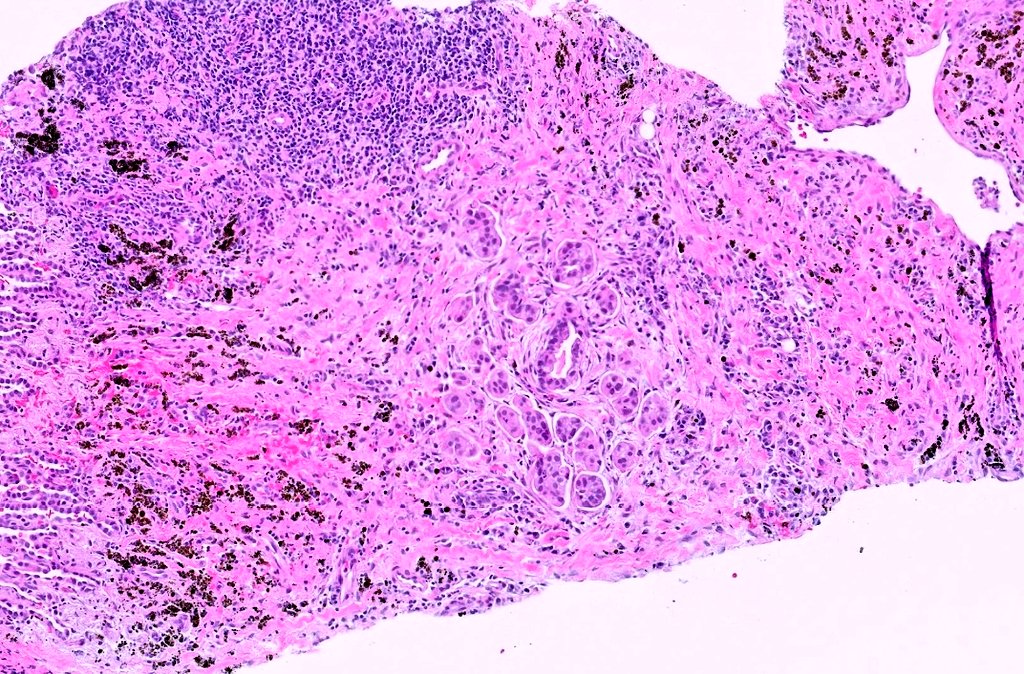 Jaclyn Rudzinski, MD tweet media