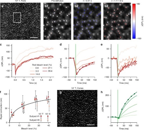 NEIDirector's tweet photo. Optoretinography reveals that rods move within milliseconds after light activation.

#NIHFunded imaging approach captures early electrical activity in rods: A new way to detect &amp; track retinal dysfunction. @NTUSg @SabesanLab @UWMedicine

@LightSciAppl:
https://t.co/NkW2Q2DEMs https://t.co/QZAoymAlzr