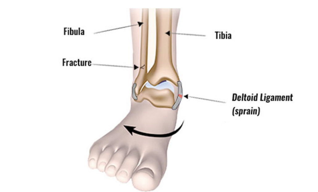 Jesse Morse, M.D. tweet media