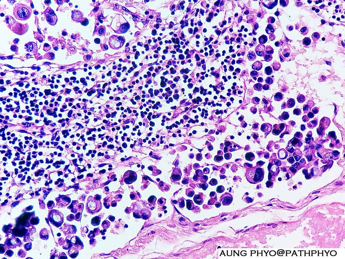 aung phyo tweet media