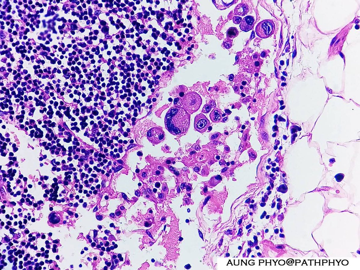 aung phyo tweet media