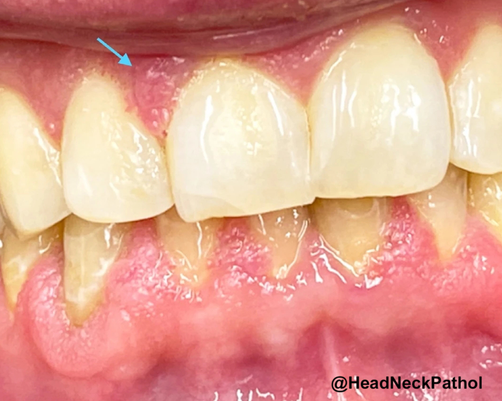 Lester Thompson tweet media