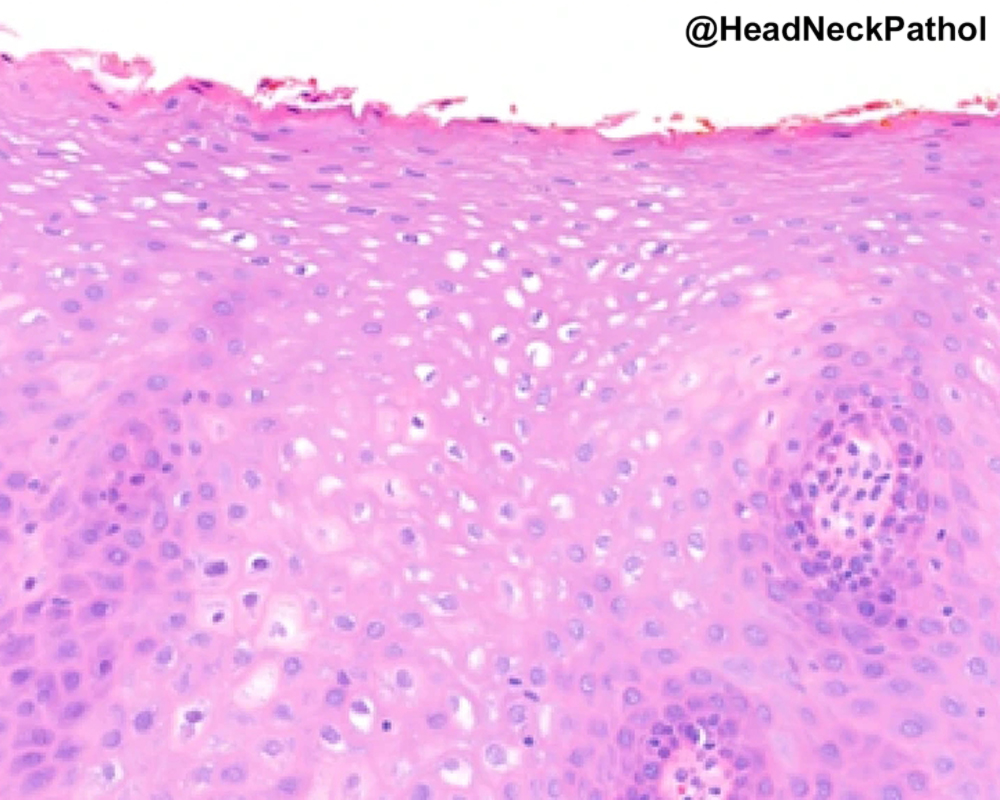 Lester Thompson tweet media