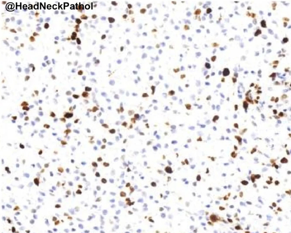 Lester Thompson tweet media