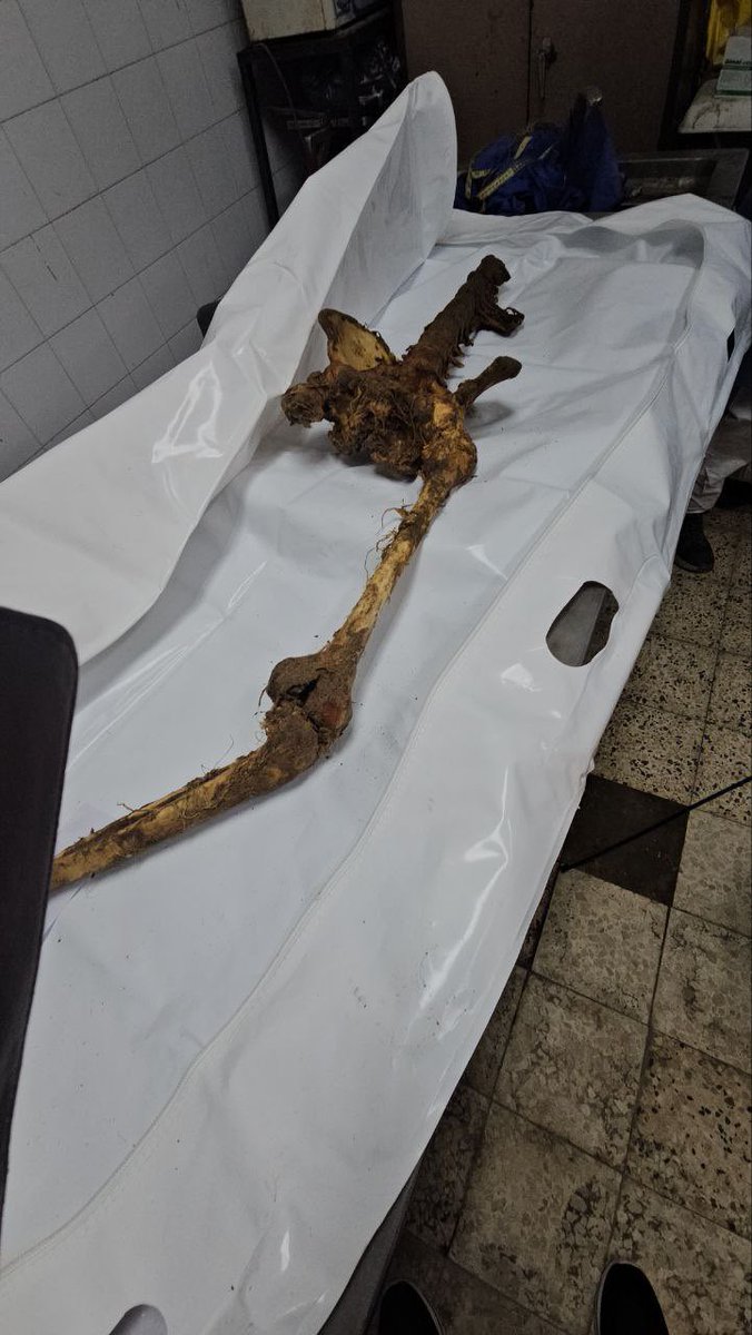 Director General of the Ministry of Health in Gaza, Dr. Munir Al-Barsh:

This is not a passing image, nor an incidental scene in a news bulletin. These are human remains. Separated bones, nameless limbs, and bodies that were not returned as they left their homes, but as killing