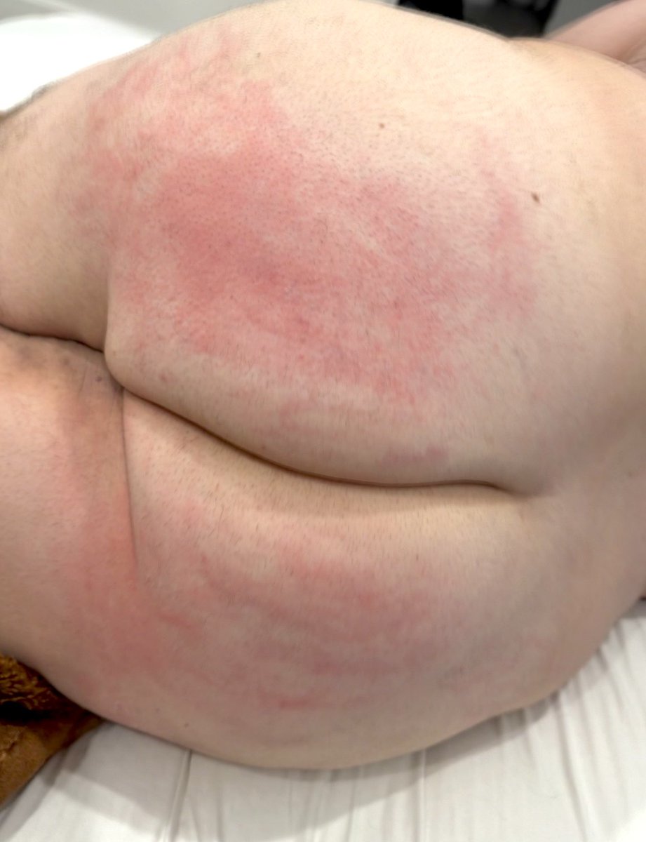 Mask Chubbingtin tweet media