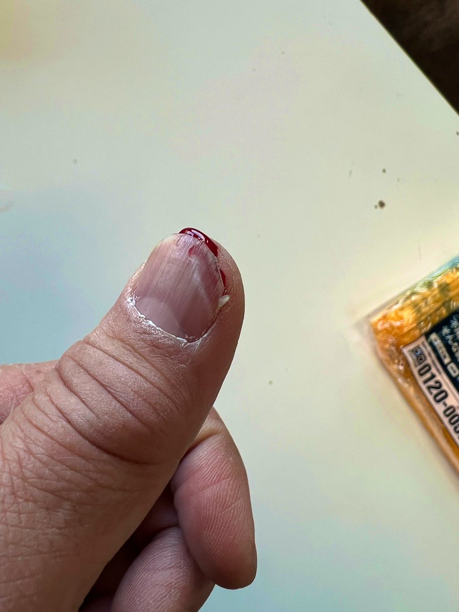 売り物バイク磨いてて指先ぶつけた😭 爪割れたのでそこだけ剥いでやろ