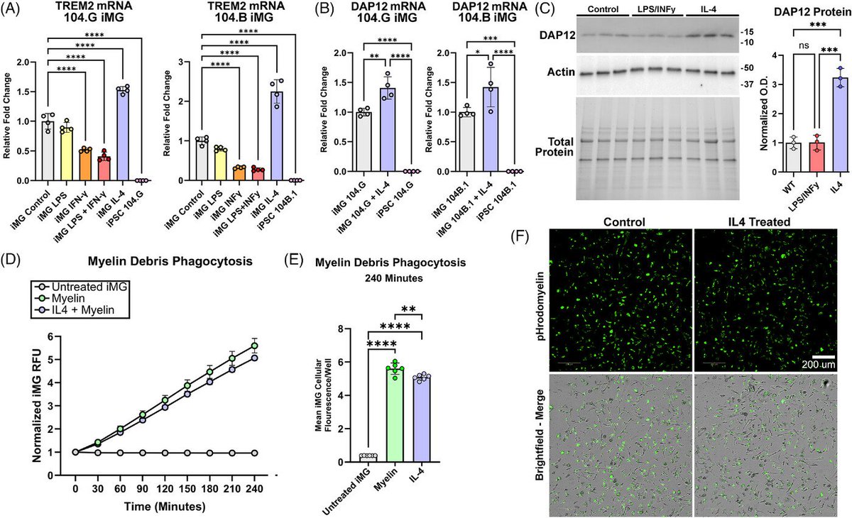 LukensJohnR's tweet photo. Generation and characterization of iPSC‐derived microglia for in vitro modeling of stimuli‐specific neuroimmune responses @alzdemjournals  https://t.co/AzIufFxk0n https://t.co/HwlYYwb7LC