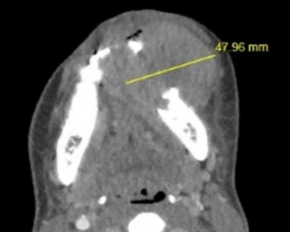 Head Neck Pathol tweet media