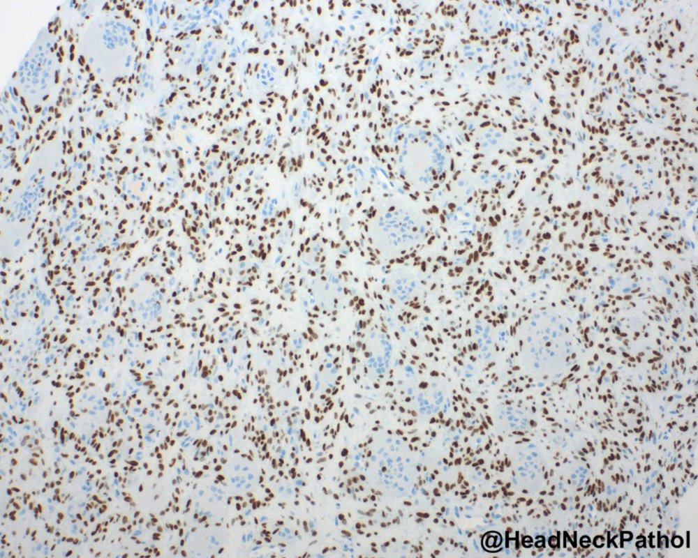 Lester Thompson tweet media