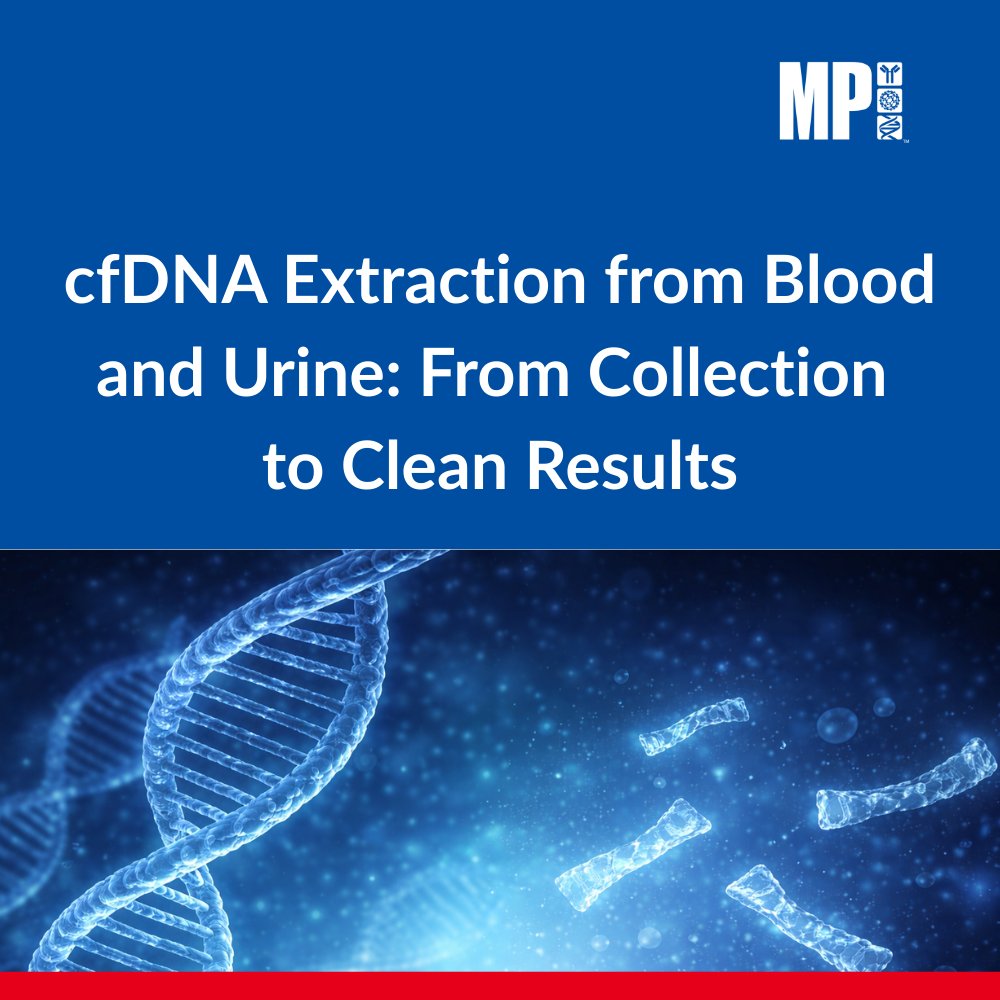 mpbiomedicals's tweet photo. 🧬Cell-free DNA (cfDNA) is low-abundance, highly fragmented, and sensitive to pre-analytics. Explore cfDNA vs gDNA differences, workflow pitfalls, and extraction approaches in our latest blog.
📖 Read the full cfDNA blog: https://t.co/mjbzuzBIg1
#cfDNA #gDNA #extraction #lifescience #magbeads #spineasy