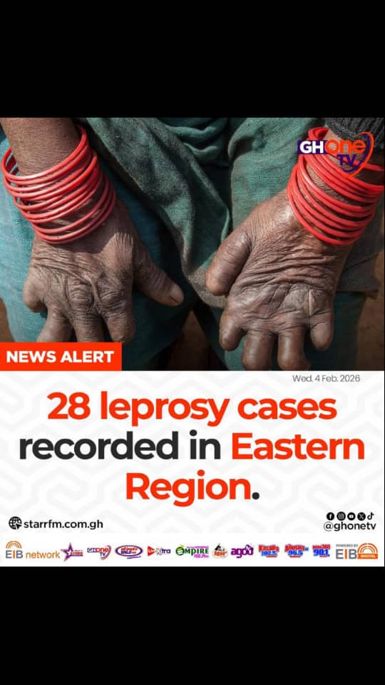 Centre for NTD Research (CNTDR) - UHAS tweet media