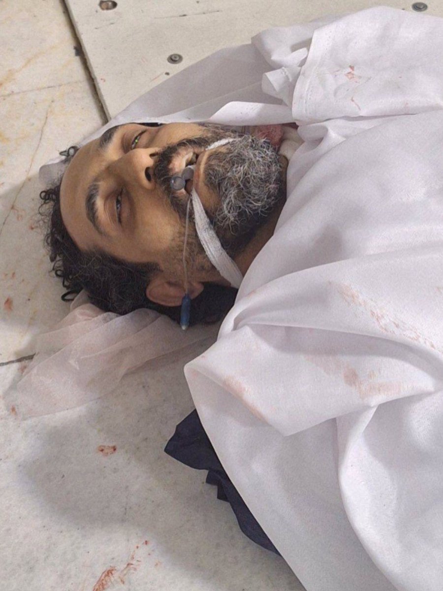 🚨🚨🚨 Content warning: This material may be disturbing. Please avoid viewing if you have heart conditions or are sensitive to distressing content.
 ‼️‼️‼️
These pictures are posted here as a proof of Islamic regime’s war crime. Killing thousands and thousands of innocent people