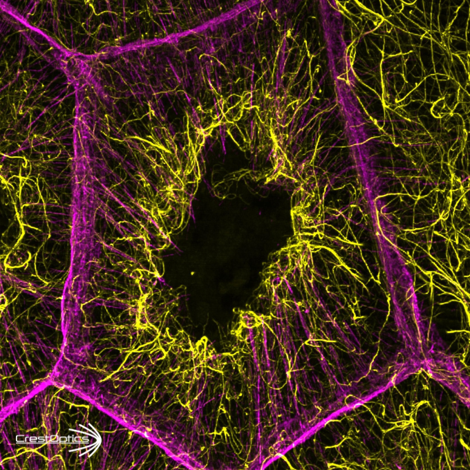 CrestOptics tweet media