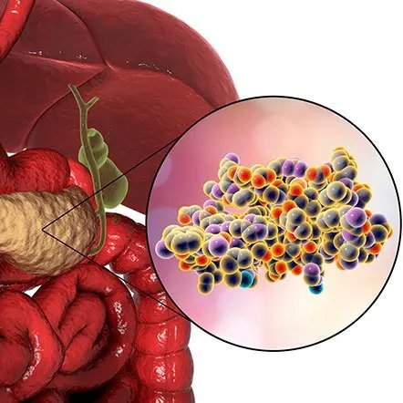 ÖNEMLİ KAN TAHLİLİ PARAMETRELERİ VE ANLAMLARI

– Trigliserit (TG):
Enerji fazlası ve insülin direncinin göstergesi
→ Yüksek = şeker, alkol, insülin fazlalığı

– TG / HDL Oranı: (En kritik oranlardan biri) 
→ İnsülin direnci, kalp krizi ve metabolik sağlık göstergesi 
• <2 iyi