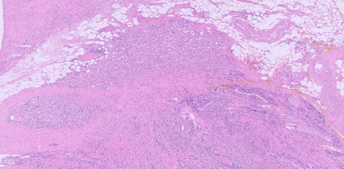 Lorand Kis tweet media