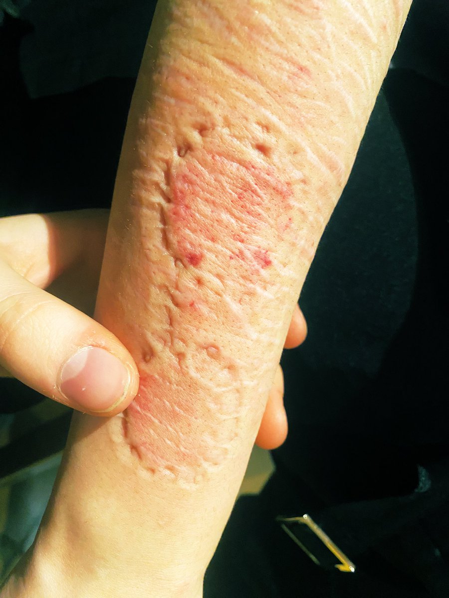 ful_maim tweet media